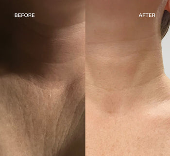 The Max Hydration Set