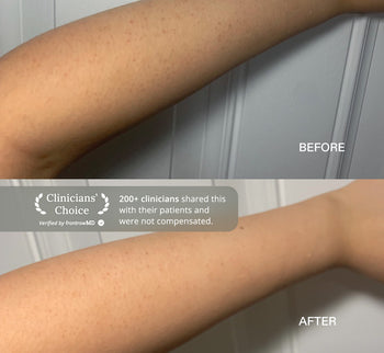 Supermochi Body Exfoliator⁺